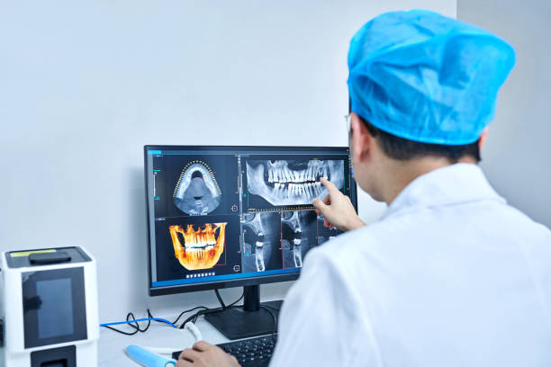 Best Emergency Root Canal Treatment in Bellbrook, OH